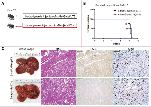 Figure 5. FASN expression is not upregulated along c-Met/β-catenin driven hepatocarcinogenesis. (A) Study design: activated forms of c-Met and β-catenin were hydrodynamically injected together with Cre into FASNfl/fl mice (c-Met/β-catenin/Cre, n = 4). This method allows the deletion of FASN while simultaneously expressing c-Met and β-catenin in the same FASNfl/fl hepatocytes. As a control, c-Met and β-catenin were injected in the same mice together with the empty vector (c-Met/β-catenin/pT3, n = 4). (B) Survival curve of c-Met/β-catenin/Cre mice (n = 4) and c-Met/β-catenin/pT3 injected FASNfl/fl mice (n = 4), P = 0.16. (C) Histologically, well to moderately differentiated HCC were found in both cohorts of mice and immunostaining demonstrated the low protein expression of FASN in c-Met/β-catenin/Cre HCC cells. Scale bar: 200µm for H&E and FASN, 100µm for Ki-67. Abbreviations: FASN, fatty acid synthase; HE, hematoxylin and eosin staining.