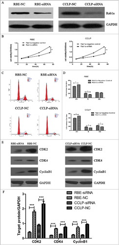 Figure 2. Suppression of Rab1a can inhibit proliferation rate of CCA cells by inducing cell cycle G1-phase arrest (A) The transfection efficiency of Rab1a siRNA in RBE and CCLP cells were verified by western blot (B) The results of CCK-8 analysis in RBE and CCLP cells under condition of Rab1a siRNA and negative control were showed,**means P < 0.001 (C) Showed the results of cell cycle analysis in RBE and CCLP cells under condition of Rab1a siRNA and negative control (D) the cell cycle results were quantified,*means P < 0.01 (E-F) the protein level of CDK2,CDK4 and CyclinB1 in RBE and CCLP cells were detected under condition of Rab1a siRNA and negative control, GAPDH was the internal control, and the results were quantified and statistically analyzed.