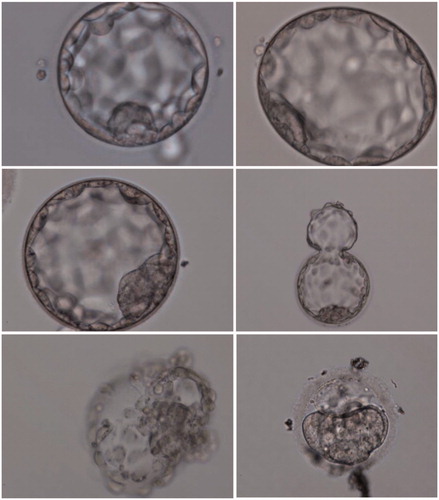 Figure 1. Blastocyst micrographs ×200. Varieties of blastocysts. High-quality embryos (3AA, 4AA, 5AA, 6AA). Blastocyst of poor quality (2CC). (1) Trophectoderm. (2) Intracellular mass. (3) Blastocyst with the beginning of hatching. (4) Blastocyst culminating in the hatching. (5) Fragmentation above 50%.