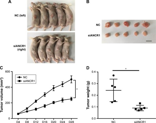 Figure 3 ANCR knockdown inhibits NPC cell proliferation in vivo.