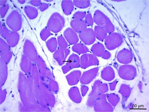 Figure 8 Cross-sections of the fibers in the micrograph of the ischemia reperfusion group show a rounded shape of the cross-sections and middle position of the core (arrow), advanced atrophy in the muscle fibers are observed. H&E ×400.