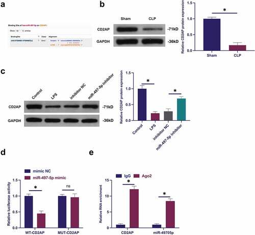 Figure 5. MiR-497-5p targets CD2AP. (a): Forecast of binding sites of CD2AP and miR-497-5p via Bioinformatics website http://starbase.sysu.edu.cn/; (b): Test of CD2AP in septic rats via Western blot; (c): Examination of the impact of knockdown of miR-497-5p on CD2AP in BEAS-2B cells via Western blot; (d): Validation of the targeting of CD2AP with miR-497-5p via deal luciferase report experiment; (e): Verification of the binding of circVMA21 with CD2AP via RIP experiment; Representation of the data was as mean ± SD, N = 3; * P < 0.05.