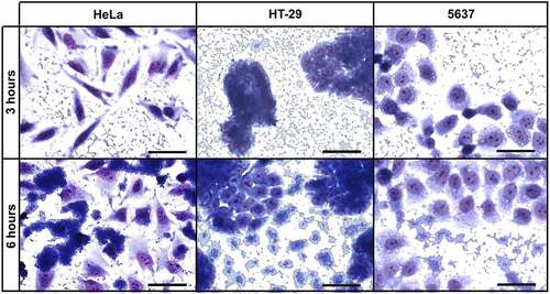 Figure 5. Qualitative adherence assay of UPEC-46 with different cell lineages. The patterns were identified after 3 h and 6 h of infection, in the presence of 1% D-mannose, using HeLa (cervical carcinoma), HT-29 (colorectal adenocarcinoma) and 5637 (human urinary bladder) cells. Evaluation of patterns by light microscopy. Bars = 50 µm