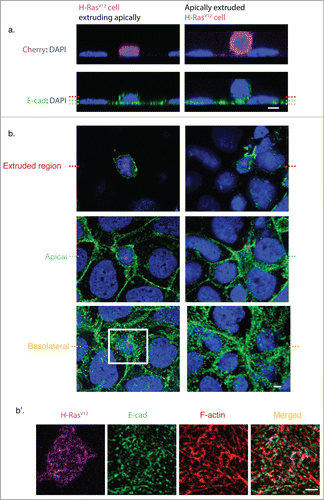 Figure 2. Epithelial organization during the stages of oncogenic cell extrusion. (a) Immunofluorescence staining of E-cadherin (green) and DAPI (blue). XZ cross-section of an H-RasV12 expressing cell extruding apically (left panel), and an H-RasV12 expressing cell that has extruded and is loosely attached to the monolayer (right panel). Red dotted line indicates the location of the Z plane for the extruded region, cyan dotted line indicates the apical Z plane of neighboring cells and yellow dotted line indicates the basolateral Z plane of the Caco-2 monolayer. (b) Confocal XY sections of (a) from an H-RasV12 expressing cell extruding apically (left panel) and an extruded H-RasV12 expressing cell that remains loosely attached to the monolayer (right panel). Magenta asterisk indicates the position of the H-RasV12 expressing cell. (b’) Magnified image of the basolateral cell-cell contacts between the extruding cells (H-RasV12, Magenta) and neighboring cells as indicated by a white box in (b). Immunofluorescence staining of E-cadherin (green), F-actin (phalloidin, red), DAPI (blue) and the merged image of E-cad and F-actin. Scale Bars: 5 μm.