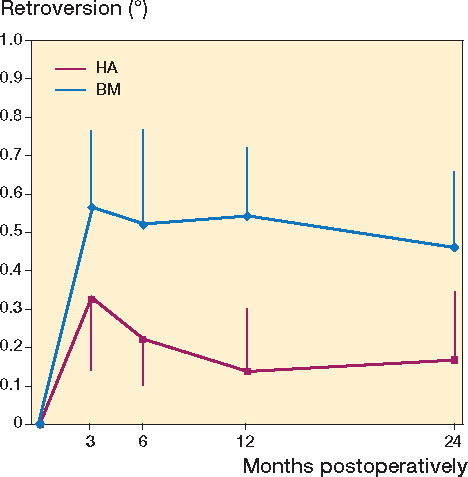 Figure 4. Retroversion of hydroxyapatite- (HA-) and Bonemaster- (BM-) coated Taperloc stems after 2 years, analyzed by radiostereometric analysis. Results are in degrees with standard error of the mean.