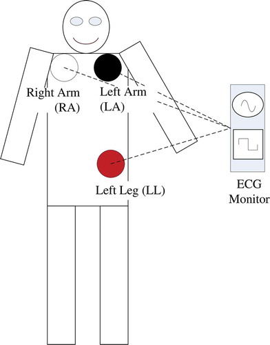 Figure 3. Proper placement of three limb electrodes on a driver’s body.