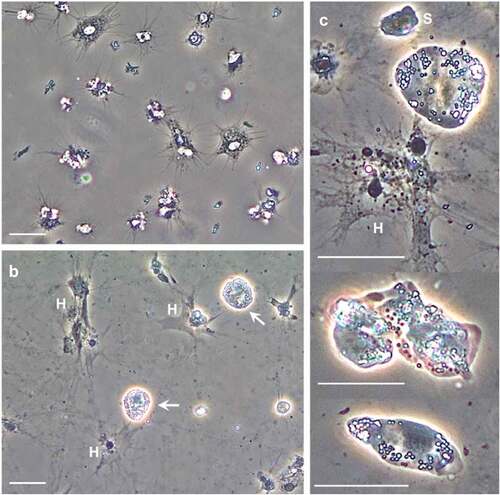 Figure 1. Hematodinium sp. morphotypes in the haemolymph of shore crabs, Carcinus maenas. Freshly withdrawn haemolymph was inspected using phase contrast microscopy. a) Appearance of haemolymph absent Hematodinium sp. b) Hematodinium sp. (white arrows) are highly refractile compared to shore crab haemocytes (H). When in contact with a surface, the haemocytes settle, spread, and lose their refractile properties. c) Higher magnification views of Hematodinium sp. variation; small (S) and large uninucleate, irregular and elongate shapes. Scale bars represent 20 µm (a, b) and 25 µm (c).