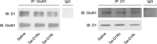 Figure 1 Effects of intrastriatal administration of Tat-fusion interfering peptide (Tat-D1Ri) on D1R–GluN1 interactions.