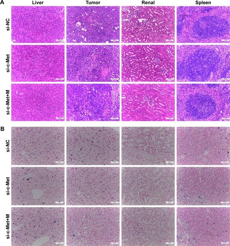 Figure 7 H&E staining and Prussian blue staining in tumor, renal and spleen tissue sections.Notes: (A) Histological examination of the tumor, liver, spleen and kidney with H&E staining. (B) Prussian blue staining in tumor, renal and spleen tissue. Prussian blue spots of Gal-PEI-SPIO appearing as blue spots accumulated in tumor and spleen, but not in the kidney.Abbreviations: H&E, hematoxylin-eosin; NC, negative control; M, magnet; Gal-PEI-SPIO, galactose-polyethylenimine-superparamagnetic iron oxide.