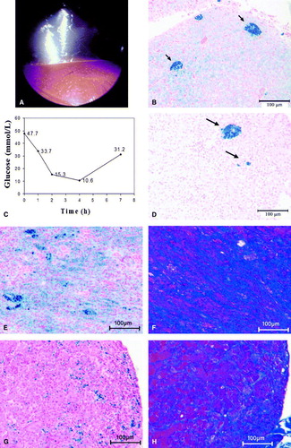 Figure 1.  Haemosiderosis (1a to 1d) in a chestnut-fronted macaw (A. severa) and (1e to 1h) in a military macaw (A. militaris) with concurrent diabetes mellitus. 1a: Endoscopic view of the liver from the left caudal thoracic air sac. A miliary distribution of yellow foci is visible on the hepatic surface. 1b: Liver biopsy at presentation showing coarse focal accumulation of iron within macrophages (blue staining, arrows), as well as diffuse iron staining within hepatocytes throughout the parenchyma (Perl's stain). 1c: Blood glucose curve following intramuscular administration of 0.55 IU/kg porcine PZI insulin. The plasma glucose nadir typically occurs between 1 and 3 h after administration, and the effect lasts approximately 8 h. 1d: Necropsy sample of liver collected 24 months after initial presentation. The bird had received eight courses of the iron chelator deferoxamine and its diet had been changed to a low-iron content pellet. Some coarse aggregates are still present (arrows) but iron staining of the hepatocytes is much reduced compared with (1b) (Perl's stain). 1e: Liver biopsy showing marked haemosiderosis (Perl's stain). 1f: A parallel section to (1e) showing increased collagen deposition (blue areas; Masson's Trichrome stain). 1g: Pancreatic biopsy showing moderate haemosiderosis (Perl's stain). 1h: A parallel section to (1g) showing increased in collagen deposition within the pancreatic interstitium (Masson's Trichrome stain).