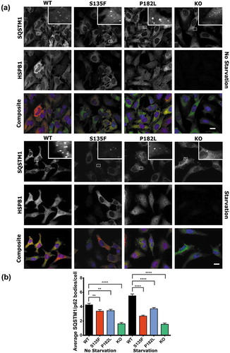 Figure 6. HSPB1 mutations and KO lead to decreased formation of SQSTM1/p62 bodies. Immunofluorescence microscopy analysis of HeLa cells expressing WT HSPB1 (WT) or the mutants (S135F and P182L) and of KO cell lines, treated with serum starvation for 3 h or left untreated. (a) Cells were stained for HSPB1 (red), SQSTM1 (green) and DAPI (blue). Scale bar: 20 µm. (b) Quantification of average SQSTM1/p62 bodies per cell. N > 2000 cells from 2 independent experiments. One-way ANOVA analysis with Tukey’s correction test. ** = P < 0.01, **** = p < 0.0001, Error bars are mean with 95% C.I.