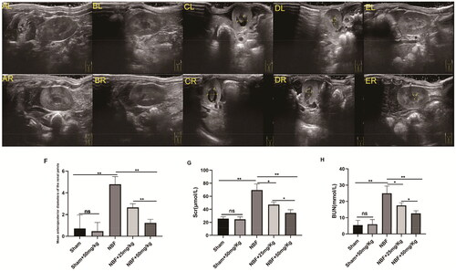 Figure 1. Ultrasound images of different groups show the difference in diameter between the anterior and posterior renal pelvis.ALandAR: left and right kidneys in the sham group; there was no obvious hydronephrosis in the renal pelvis. BLandBR: left and right kidneys in the sham + ABT-263 (50 mg/kg) group; there was no notable hydronephrosis in the renal pelvis. CLandCR: left and right kidneys in the neurogenic bladder fibrosis (NBF) group andhydronephrosis in the renal pelvis. DLandDR: left and right kidneys in the NBF + ABT-263 group (25 mg/kg); compared with the NBF group, hydronephrosis in the renal pelvis was significantly reduced. ELandER: left and right kidneys in the NBF + ABT-263 group (50 mg/kg). Compared with the NBF + ABT-263 group (25 mg/kg), hydronephrosis in the renal pelvis was significantly reduced. The yellow arrow indicates the hydronephrosis area. f: Statistical histograms of the anterior and posterior diameters of the renal pelvis (the anterior and posterior diameters of the left and right kidneys were added together and then averaged); gandh: Statistical histograms of serum creatinine (SC) and blood urea nitrogen (BUN) levels. Data are expressed as the mean ± SEM; ns p > 0.5, *p < 0.01, **p < 0. 001. All experiments were repeated three times.