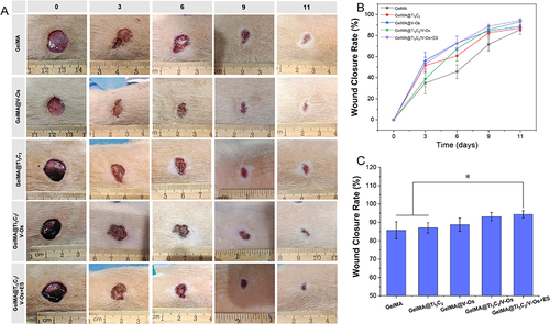Figure 7 (A) The closure rate of the wound defects with different treatments at days 0, 3, 6, 9, and 11. (B and C) Quantitative analysis of wound closure rate % (*P < 0.05, n=3).