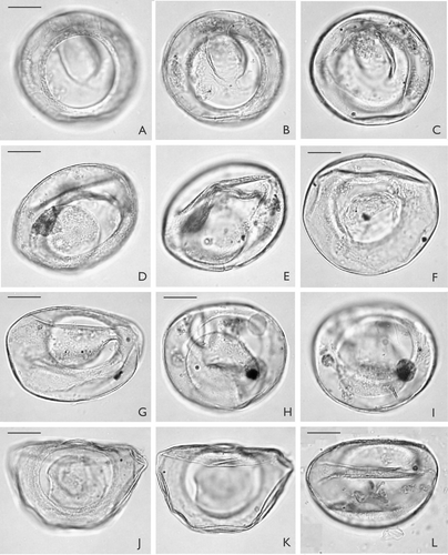 A–L. Palaeostomocystis subtilitheca sp. nov. from core DA00-03, Egedesminde Dyb, central West Greenland. Note that the operculum occurs in the interior of each specimen except G. The same scale is used for all specimens. A. Holotype. MGUH 26841. Apical view in high focus. Note the pylome rim. B. Same specimen as (A). Apical view in sectional focus. C. Same specimen as (A). Apical view in low focus. D. MGUH 26842. Semilateral view, sectional focus. E. Same specimen as (D). Semilateral view in low focus. F. MGUH 26843. Apical view in low focus. G. MGUH 26845. Antapical view in high focus. H. MGUH 26846. Antapical view in high focus. Note small pseudopylome at 2.00 o'clock. I. Same specimens as (H). Antapical view in low focus. J. MGUH 26847. Apical view in high focus. Specimen partly damaged by lateral compression. K. Same specimen as (J). Apical view in low focus. L. MGUH 26851. Apical view in low focus. Note dome-shaped operculum in the bottom of the vesicle. Scale bar – 15 μm.