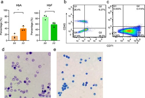 Figure 1. The results of hemoglobin electrophoresis and the purity of isolated NRBCs. (a) The average HbA and HbF levels of full-term female neonates and preterm female neonates. (b) Flow cytometry analysis of MNCs. (c) Flow cytometry analysis of isolated NRBCs, in which Q3 corresponds to CD71+ CD45− cells. (c) Wright’s staining (100×). (d) Brilliant cresyl blue staining of NRBCs (100×).