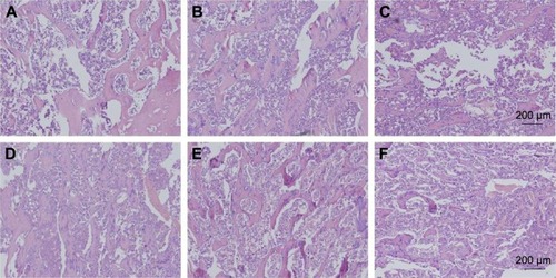 Figure 8 Histological analyses of the explants 8 weeks (A–C) and 12 weeks (D–F) after implantation.