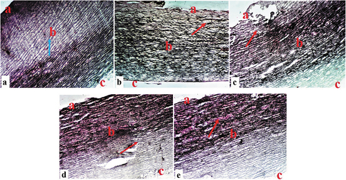 Figure 7. Composite photomicrographs of non-diabetic and diabetic pig aorta showing normal distribution of the collagen fibers of the aorta at the tunica intima (a), tunica media (b), and tunica adventitia (c) (blue arrow) (a); collagen fiber disruption (red arrow) (b); and a dose-dependent collagen fiber repair (arrow) (c, d, & e). Masson’s trichrome stain X 250. A = aorta of normal control pigs, B = aorta of diabetic control pigs, C = aorta of pigs treated with 250 mL/day Camel milk, D = liver of pigs treated with 500 mL/day Camel milk, E = aorta of pigs treated with Metformin.