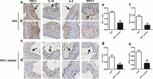 Figure 5. Platelet transfusion from wild-type C57BL/6 mice inhibited infiltration of inflammatory factors in the aorta from atherosclerotic mice after fed with a high-fat diet (HFD) for 8 weeks. (a) and (c) Immunostaining for tumor necrosis factor-α (TNF-α), interleukin-1β (IL-1β), IL-6, and monocyte chemoattractant protein-1 (MCP-1); the black arrow represents the lesion. (b) and (d) An enlarged view of the part pointed by the black arrow in (a) and (c) respectively; and the red arrow showing positive cells for each cytokine. (e)–(h) Quantitative analysis of TNF-α, IL-1β, IL-6, and MCP-1; cytokines + index means mean density, defined as positive integrated optical density (IOD)/pixel area of the tissue (AREA) for each immunohistochemical image. Abbreviations: HFD, high-fat diet.