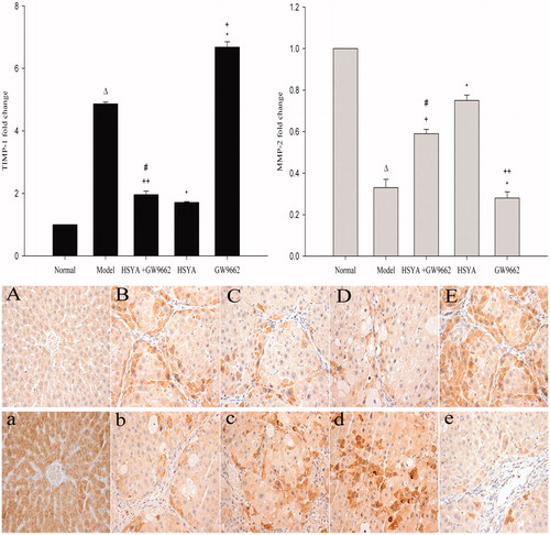 Figure 4. Effects of hydroxysafflor yellow A (HSYA) on TIMP-1 and MMP-2 protein expression. TIMP-1 and MMP-2 in liver sections were examined by immunohistochemistry and observed using a light microscopy at 400× magnification. Panels (A)–(E) represent TIMP-1 expression in the normal group, model group, HSYA+GW9662 group, HSYA group, and GW9662 group, respectively. Panels (a)–(e) represent MMP-2 expression in the normal group, model group, HSYA+GW9662 group, HSYA group, and GW9662 group, respectively. Results are expressed as fold increase over the control group. Δp < 0.01 versus normal group; *p < 0.01 versus model group; +p < 0.01 and ++p < 0.05 versus HSYA group; #p < 0.01 versus GW9662 group.