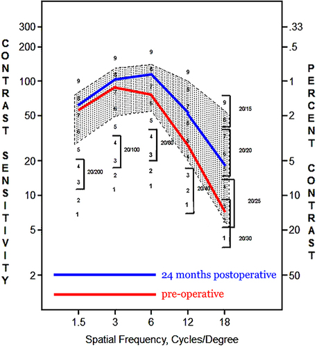 Figure 2 Low contrast sensitivity data comparison: pre-operative in red, compared to 24 months post-operative in blue using the Stereo Vision device.