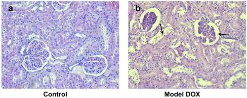Figure 6. Photomicrographs of rat kidney bark stained with H&E × 400. (a) Control (group 1) - normal structure of nephrons. (b) DOX-treated animals (group 8; cumulative dose: 20 mg/kg, b.w., i.p.) - damaged tubular cells (left arrow) and total collapse of glomeruli (right arrow).
