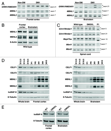Figure 1. DM1-associated RNA spliceopathy and the expression of splicing regulators in the CNS. (A) Representative splicing analysis of candidate genes in the frontal cortex and brainstem of DM1 patients (n = 4–5) and non-DM controls (n = 2) by RT-PCR (Table S1). The alternative exons are indicated on the right of each panel. The higher molecular product results from the amplification of the transcript that includes the alternative exon (+); the lower band does not include the alternative exon (-). (B) Western blot analysis of MBNL1 and MBNL2 in the frontal cortex and brainstem of wild-type animals (Table S1), following long migration times to increase resolution and separation of protein isoforms. β-Actin was used as loading control. (C) Representative splicing analysis of alternative exons of Grin1/Nmdar1, Mapt/Tau, Mbnl1 and Mbnl2 by RT-PCR (Table S1) in the spinal cord of one-month-old DMSXL homozygous mice and wild-type controls (n = 3, per genotype). Newborn splicing profiles (P1) were determined in a cDNA pool prepared from three wild-type animals. Notably, DMSXL spinal cord exhibited increased exclusion of both Grin1/Nmdar1 exon 5 and Mapt/Tau exon 10, as well as a mild increase in the inclusion of both Mbnl1 exon 7 and Mbnl2 exon 7. (D) Western blot analysis of splicing regulators throughout wild-type embryonic development (E12.5, E14.5, E18.5), in newborn (P1), postnatal day 8 (P8), and adult mice aged one (M1), four (M4) and 10 (M10) months (Table S2). Protein extracts from three individual animals were pooled for each developmental stage, electrophoresed and analyzed in three independent assays. Representative western blots are shown for frontal cortex and brainstem. Over-exposed of MBNL1 and MBNL2 western blots are shown to confirm low protein expression during embryonic stages and at P1. (E) Western blot analysis of hnRNP H in the frontal cortex and brainstem of DMSXL and wild-type animals at one month of age (Table S2), when missplicing dysregulation is more pronounced. Protein extracts from three individual animals of each genotype were pooled. β-Tubulin was used as loading control.