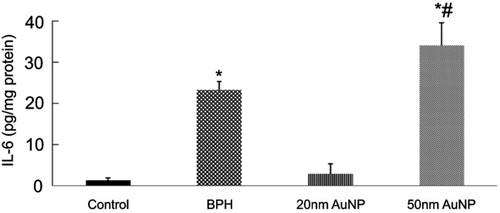 Figure 7 Effect of AuNPs treatment on the prostatic tissue level of IL-6. Data represent the mean ± SEM.*P<0.05 compared to the control group. #P<0.05 compared to the BPH group.Abbreviations: BPH, benign prostatic hyperplasia; AuNPs, gold nanoparticles; IL-6, interleukin-6.