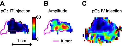 Figure 5 In vivo tumor oxygen images. Nude mice with LS-174T xenograft tumor on leg flank were used to monitor in vivo oxygen measurements. pO2 of tumor was first imaged by intravenously injected trityl. After half-hour washout, tumor mice were injected with 3.36 mg of FMSN-trityl and the intracellular pO2 levels were monitored by EPRI. Tumor outlines obtained from MRI were illustrated in pink. Color bar showed pO2 scale in the range 0–60 mmHg. (A) pO2 image measured from FMSN-trityl via IT injection. (B) Signal amplitude acquired from FMSN-trityl via IT injection. (C) pO2 image measured from trityl via IV injection.