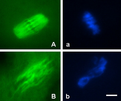 Figure 2 Morphology of meiotic spindle organization and chromosome alignment in normal and abnormal mouse oocytes. (A) Oocyte with normal meiotic spindle organization (green); (a) The same oocyte with normal chromosome alignment (blue); (B) Oocyte with abnormal meiotic spindle organization (green); (b) The same oocyte with abnormal chromosome alignment (blue). Scale bar indicates 20 μm.