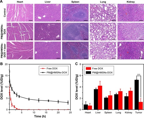 Figure 8 In vivo histology, pharmacokinetics, and biodistribution analysis.Notes: (A) Representative tissue sections of mice stained with H&E after different treatments. Scale bar: 50 µm. (B) In vivo pharmacokinetics of PM@HMSNs-DOX and free DOX in mice. (C) Quantification of DOX accumulated in different organs and tumor using fluorescence spectroscopy. DOX uptake is expressed as injected dose per gram of tissue (%ID/g). Data are presented as mean ± standard deviation (n=3). ***P<0.001.Abbreviations: PM, polydopamine-coated MoSe2; HMSNs, hollow mesoporous silica nanoparticles; DOX, doxorubicin.