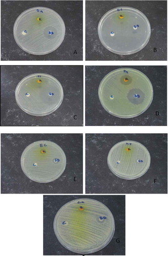 FIGURE 2 Testing the susceptibility of microorganisms to riboflavin solution by using Kirby-Bauer disc diffusion method. The labels refer as following: A-Staphylococcus aureus, B-Enterococcus faecalis, C-Salmonella thyphi, D-Pseudomonas aeruginosa, E-Escherichia coli, F-Klebsiella pneumoniae, and G-Candida albicans, R-Riboflavin, SD-Standard drug, and C-Control.
