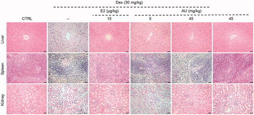 Figure 1. Pathological examination of haematoxylin and eosin-stained organs (liver, spleen and kidney) from osteoporosis mice (200×) (Scale Bar: 50 μm) (n = 3). CTRL: control; Dex: dexamethasone; E2: oestradiol; AU: aucubin.