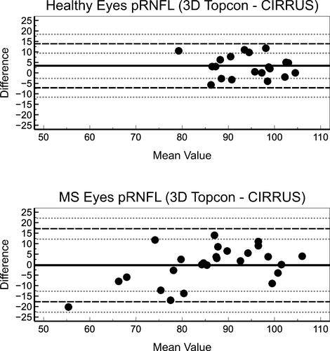 Figure 3 Bland-Altman plots depict the agreement between Topcon and CIRRUS for RFNL measurement in healthy (top) and MS patients’ eyes (bottom).