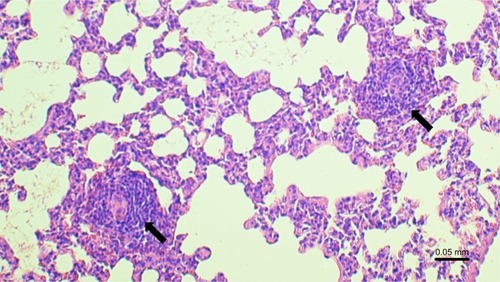 Figure 4 Lymphoid follicle formation (arrows) in the lung in smoke-exposed guinea pig.