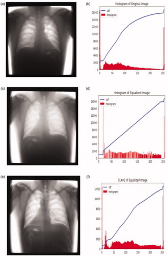 Figure 1. Original image, global histogram equalized image, CLAHE equalized image, and their respective histograms. (a) Original Image (b) Histogram of Original Image. (c) Global Histogram Image (d) Histogram of GHE Image. (e) CLAHE Image (f) Histogram of CLAHE Image.