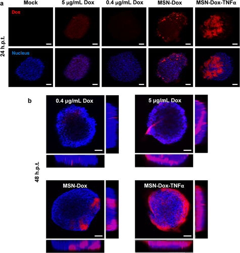 Figure 6 Impact of Dox uptake on MSN-Dox-TNFα treatment in 3D u87MG cell spheroids. U87MG cells were grown as 3D spheroids, and treated with Dox (0.4 or 5 μg/mL), MSN-Dox, or MSN-Dox-TNFα. The nuclei were stained by DAPI (blue fluorescence), and red fluorescence signals were from Dox. 3D cell spheroids were fixed at (a) 24 h or (b) 48 h post-treatment. (b) It also shown the images along z-axis to demonstrate the penetration ability of NP. Fluorescence images were obtained with confocal microscopy at the indicated time points. Scale bars: 100 μm.