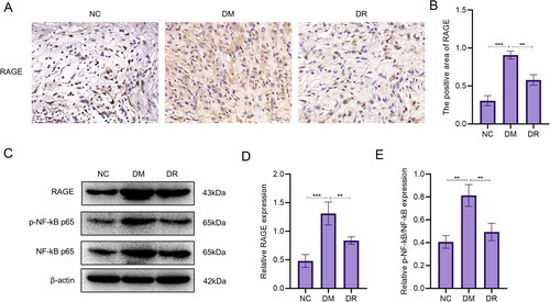 Figure 9. RSV inhibits the AGE-RAGE signalling pathway. (A) Immunohistochemical images of RAGE. Scale bar is 50 µm. (B) Immunohistochemical statistics of RAGE. (C) WB analysis of AGE-RAGE signalling pathway-related targets. (D) WB analysis of statistical maps.