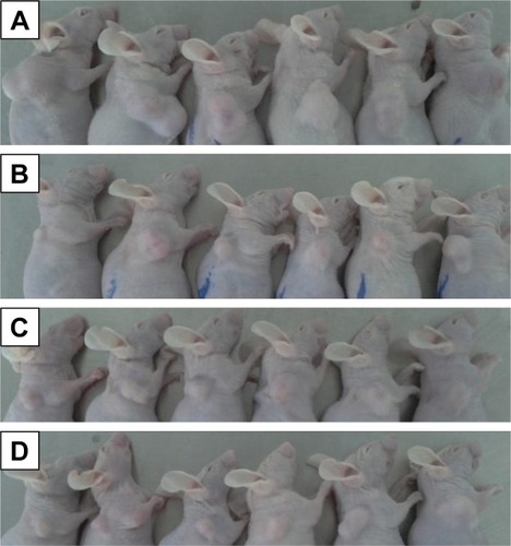 Figure 7 The tumor volume in nude mice transplanted with a human adenocarcinoma (A549) cell line on day 16.Note: (A) Control group, (B) free PTX/CUR, (C) PTX/CUR LPs and (D) RGD-PTX/CUR LPs.Abbreviations: PTX, paclitaxel; CUR, curcumin; LPs, liposomes; RGD, arginine, glycine, aspartic acid peptide.