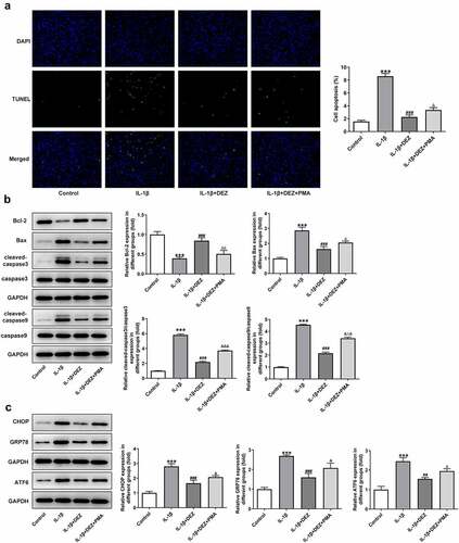 Figure 6. Inhibitory effects of DEZ on apoptosis and ERS of IL-1β induced HNPCs are diminished by MAPK pathway agonist PMA. (a) The apoptotic rate was tested with TUNEL assay. (b) The levels of apoptosis-related proteins were detected with Western blot. (c) The levels of ERS-related proteins were evaluated with Western blot assay. ***P < 0.001 vs. untreated group; #P < 0.05, ##P < 0.01, ###P < 0.001 vs. IL-1β group; ΔP<0.05, ΔΔP<0.01, ΔΔΔP<0.001 vs. IL-1β+DEZ group.