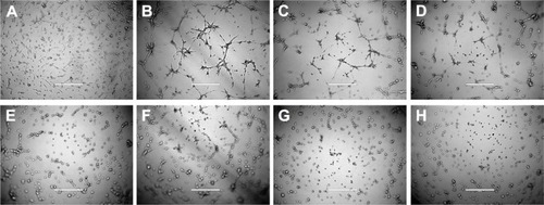 Figure 6 Destruction of VM channels in vitro formed by brain glioma U87MG cells in the 3-D Matrigel after treatment with targeting epirubicin plus celecoxib liposomes.Notes: (A) Brain glioma cells without Matrigel. (B) Brain glioma VM channels formed in the 3-D Matrigel without treatment. (C–E). Destruction of VM channels after treatment with a fixed concentration of free celecoxib (1, 5, and 10 μM, respectively). (F) Destruction of VM channels after treatment with celecoxib liposomes (10 μM). (G) Destruction of VM channels after treatment with targeting celecoxib liposomes (10 μM). (H) Destruction of VM channels after treatment with targeting epirubicin plus celecoxib liposomes (5 μM epirubicin and 5 μM celecoxib). The scale bars in A–H indicate 400 μm.Abbreviations: VM, vasculogenic mimicry; 3-D, three-dimensional.