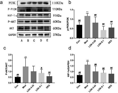 Figure 9. Lok reduces the expression of PI3K-AKT/HIF-1α signaling pathway-related proteins in the lungs of mice with OVA-induced asthma. (a) The expression of each protein was quantified using Western blot. A (Con), B (Mod), C (Lok-4.55), D (Lok-9.1), E (Dex). Ratios of (b) p-PI3K/PI3K, (c) p-AKT/AKT and (d) HIF-1α intensity. The obtained data are expressed as mean ± SD. n = 6, *p < 0.05, **p < 0.01, vs. con, #p < 0.05, ##p < 0.01, vs. Mod.