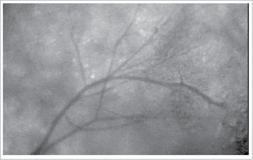 Figure 2. Overview of female NOD mouse pancreatic microvasculature (5 fold magnification). Fifteen minutes prior to IVM, Rhodamine-6G and FITC-albumin was administered via tail vein injection.