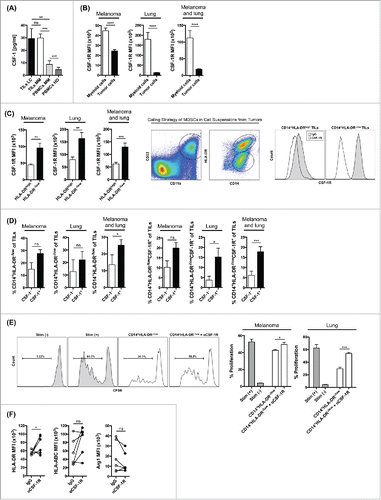 Figure 3. CSF-1/CSF-1R signaling blockade alters the function and phenotype of MDSCs from human melanoma and lung tumors. (A) Production of CSF-1 in tumor samples from patients with lung cancer, in tumor and PBMC samples from patients with melanoma, and in PBMCs from healthy donors. (B) CSF-1R expression in myeloid cells and tumor cells from tumors of patients with melanoma and lung cancer. (C) CSF-1R expression in CD11b+CD33+CD14+HLA-DRhigh and CD11b+CD33+CD14+HLA-DR−/low myeloid cells in tumors of patients with melanoma and lung cancer, gating strategy for MDSCs and representative flow histograms for CSF-1R expression. (D) Frequency of total CD11b+CD33+CD14+HLA-DR−/low and CSF-1R-expressing CD11b+CD33+CD14+HLA-DR−/low cells in cell suspensions of CSF-1+ and CSF-1− tumors. (E) T cell suppression assay with CD14+HLA-DR−/low cells enriched from cell suspensions from tumors of melanoma and lung cancer patients and pre-incubated in vitro with αCSF-1R or IgG. Percent T cell proliferation and representative histograms in CD14+HLA-DR−/low to T cell ratios of 1:1. (F) MFI for HLA-ABC, HLA-DR and Arg1 expression in CD14+ cell cultures after treatment with αCSF-1R or IgG. Data are mean +/– SEM and represent 12 melanoma patients and 12 lung cancer patients (A–D), three melanoma patients and three lung cancer patients (E), and six lung cancer patients (F).