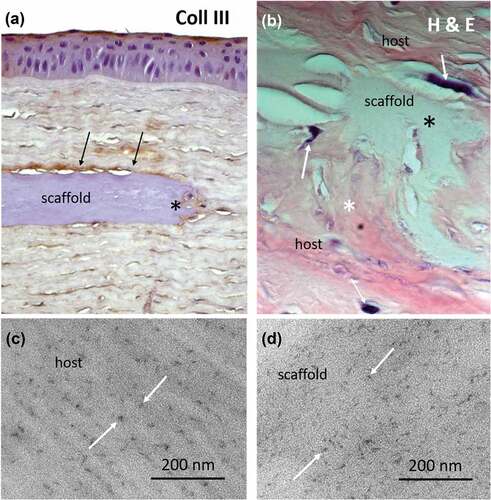 Figure 5. Evidence for stromal regeneration following implantation of a bioengineered porcine construct (BPC) scaffold into rabbit corneas for 8 weeks. (a) Immunohistochemistry of the cornea with staining for scar-type collagen III indicates limited new collagen production by host stromal fibroblasts at the lamellar interface (arrows). Note that the fibroblasts migrate along the lamellar surface until the edge of the scaffold is reached, before entering the scaffold at the edge (asterisk). (b) At the scaffold edge, fibroblasts enter the scaffold (arrows), breaking down the scaffold collagen (hematoxylin stained, gray color) and producing new host-derived collagen, as indicated by the eosinophilic pink color. (c) Transmission electron microscopy image of host rabbit stromal collagen stained for proteoglycans, visible as dark electron-dense spots (arrows). Note the distribution of proteoglycans in parallel lines, following the parallel orientation of collagen fibrils in the native rabbit stroma. (bd) In the scaffold, proteoglycans are also present but appear randomly distributed (arrows).