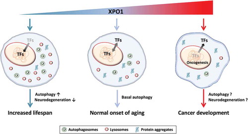 Figure 1. XPO1 levels modulate autophagy and aging. Exportin 1 (XPO1) acts a pivot that governs cell survival on one hand and cancer progression on the other. Under unperturbed conditions, XPO1-mediated nuclear export of transcription factors (TFs) maintains basal autophagy, which leads to normal onset of aging. When XPO1 is upregulated, as seen in some cancers, there is excessive loss of TFs including tumor suppressor factors from the nucleus. This aberrant level of nuclear export promotes oncogenic genes and cancer progression. Conversely, XPO1 inhibition causes enrichment of TFs in the nucleus that promote autophagy and clearance of protein aggregates leading to increased longevity.
