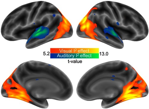 Figure 1 Brain responses associated with the visual and auditory I2 scores (p<0.05 corrected for familywise error).