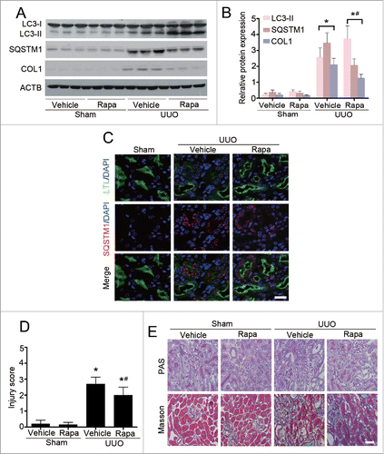 Figure 2. Enhancement of autophagy by rapamycin (Rapa) ameliorates renal interstitial fibrosis in C57BL/6 mice. (A) Immunoblot analyses of LC3, SQSTM1/p62, and COL1 in the obstructed kidneys in different groups as indicated. (B) Quantitative determination of the relative abundance of the indicated proteins among different groups. Data are means ± SEM (n = 6); *, P < 0.001 vs. sham; #, P < 0.05 vs. UUO mice treated with vehicle. (C) Coimmunostaining of LTL (green) and SQSTM1/p62 (red) in kidney sections. Scale bar: 20 μm. (D) Semiquantitative analysis of tubular damage in the obstructed kidneys. Data are means ±SEM (n = 6); *, P < 0.05 vs. sham; #, P < 0.05 vs. UUO mice treated with vehicle. (E) Representative micrographs from indicated groups with either periodic acid-Schiff (PAS; upper panels) or Masson's trichrome staining (lower panels). Scale bar: 20 μm.