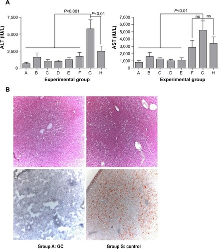 Figure 1 Effect of β-glycosphingolipids on liver injury and histology.Notes: (A) Liver enzymes were measured in the serum of all the rats in all groups. Data are shown as means + standard error. (B) Histology in five liver sections was evaluated in each of the animals and by staining with H&E (upper panel) and Oil Red O (lower panel). Representative liver biopsies from a group A animal and a group G animal (×10 magnification) reveal a significant decrease in fat content in the GC-treated animal.Abbreviations: ALT, alanine aminotransferase; AST, aspartate aminotransferase; GC, β-glucosylceramide; H&E, hematoxylin and eosin; ns, not significant.