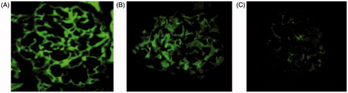 Figure 3. Indirect immunofluorescence of mouse renal cortex cryostat sections. Notes: The photomicrographs are developed to the same intensity of signal. ×400. (A) WKY 24W; (B) SHR 12W; (C) SHR 24W.