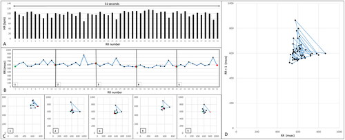 Figure 4. A. Heart rate tachogram, B. R–R tachogram and C, D. Poincaré plot construction from 50 R–R intervals in a dog with MMVD in class B1 with a HR of 99 bpm. Heart rate tachogram shows short nonlinear fluctuations in heart rate comprising isolated larger variations. R–R tachogram (B) reveals alternations between small variations (e.g. R–R 4–7), medium variations (e.g. R–R 7–11) and large variations (e.g. R–R 17–19). Sequential Poincaré plots reveal alternations between periods with clustered dots (consistent with small variations in R–R intervals) and dispersed dots (consistent with larger variations in R–R intervals, e.g. box 4). D The construction of the Lorenz plot graphic revealing a triangle shape.